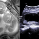 Illustration for article titled Video MRI Shows Unborn Twins in Incredible Detail